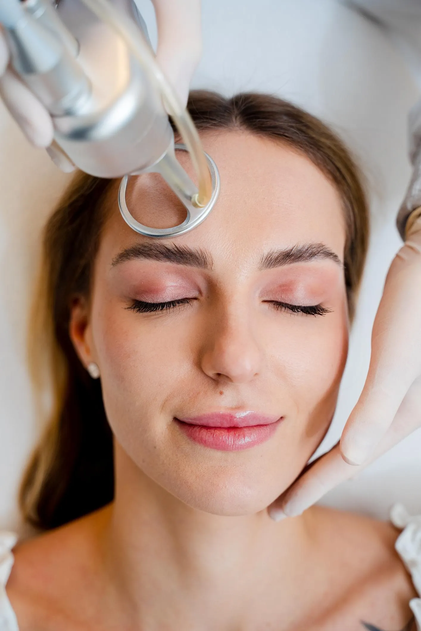 CO2 Laser treatment